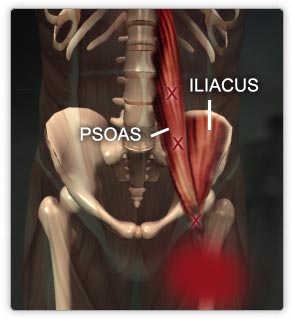 PSOAS