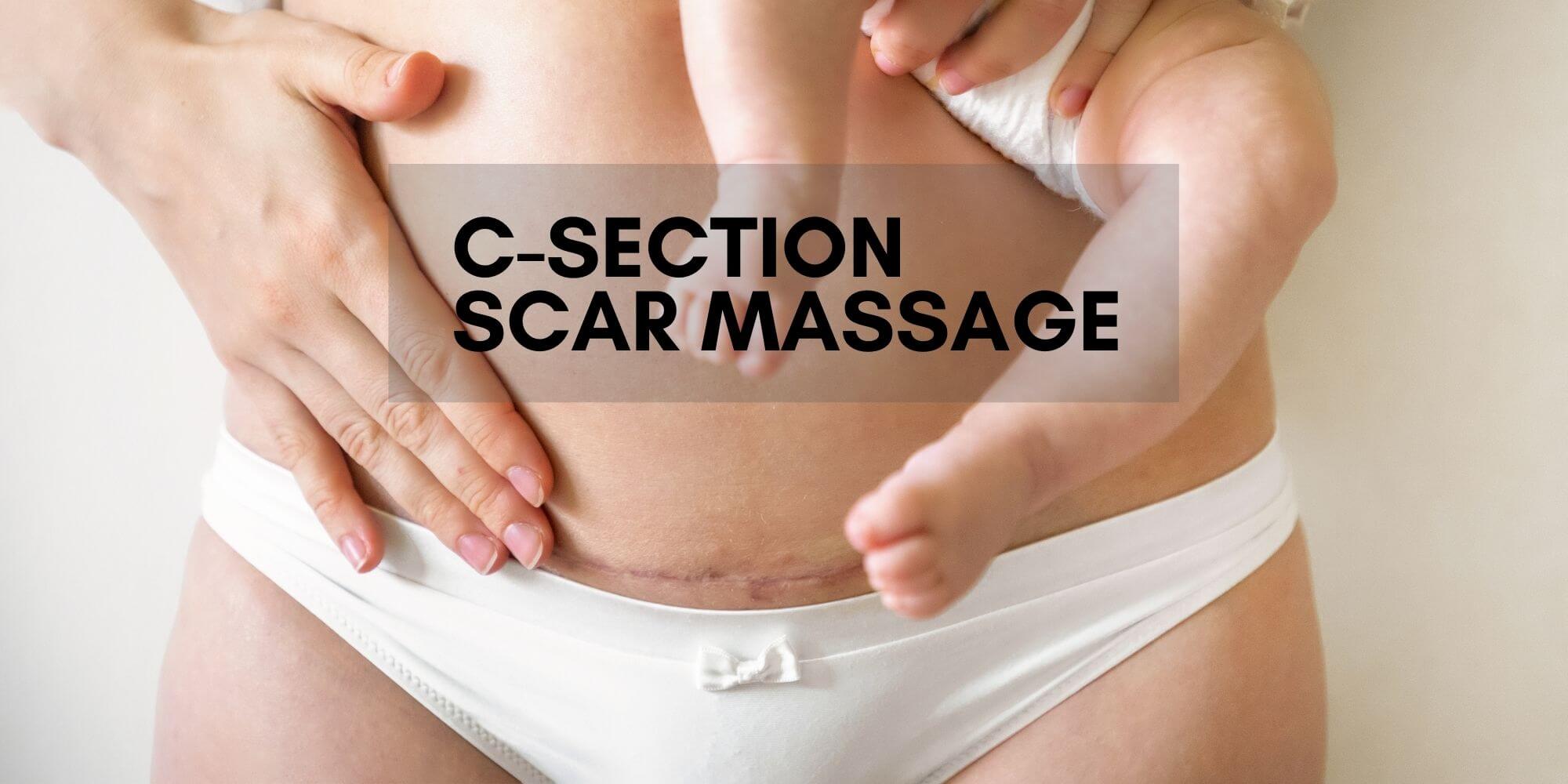 C-Section Scar Massage - Back At It Sports & Wellness